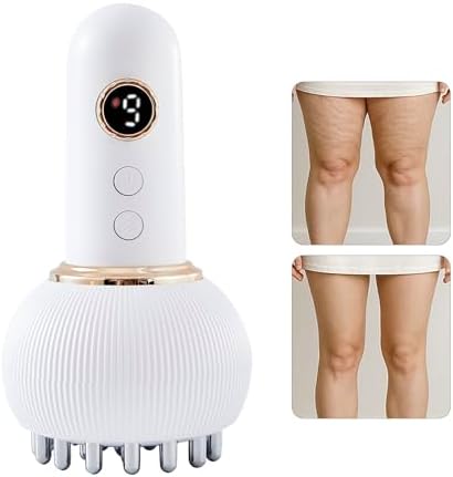 Yuonry Lymphatic Drainage Massager &amp; Anti Cellulite Massage Tool, Helps Reduce Stretch Marks &amp; Cellulite, for Legs, Arms &amp; Belly, Body Sculpting Machine with Microcurrent, Light, Heat &amp